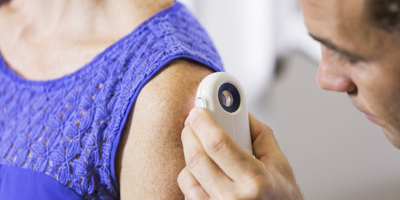 A Dermatologist Checking A Woman's Scar On Her Hand With A Micro Device.