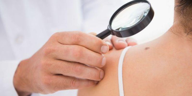 A Dermatologist Checks Woman's Skin With A Microlens.