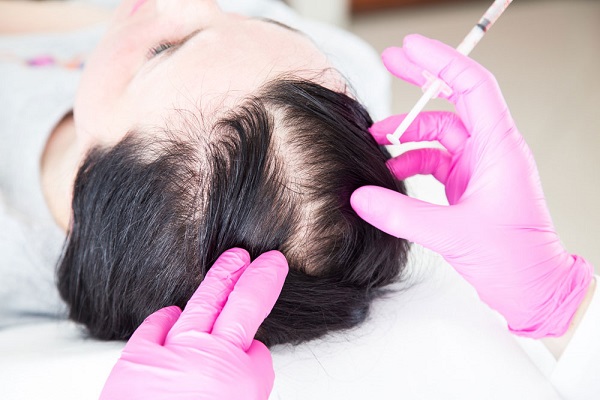 Top View Of Woman's Scalp Checked By A Dermatologist.